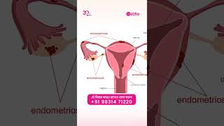 IVF setbacks aren’t the end—Dr. Bani Kumar Mitra shares your next step. #doctor #ivf #kolkataclinic