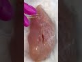 Running Continuous Subcuticular Suture