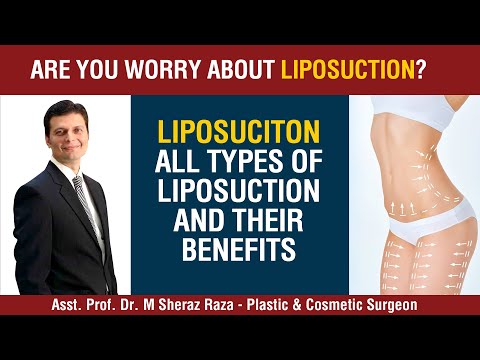 Are you looking for Liposuction? Types & Benefits by Dr. Sheraz Raza