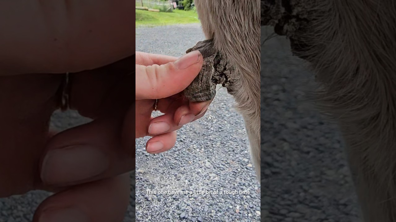 ОГРОМНОЕ удаление конского каштана, заросшего, на обеих ногах!! 