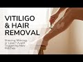 Hair Removal &amp; Vitiligo: How to Shave, Wax &amp; Laser Safely