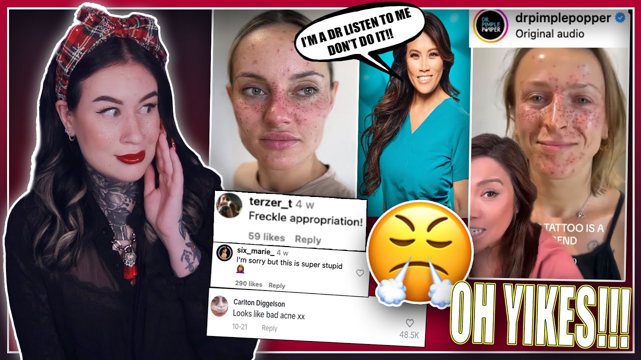 Freckle Tattoos Are CANCELLED!