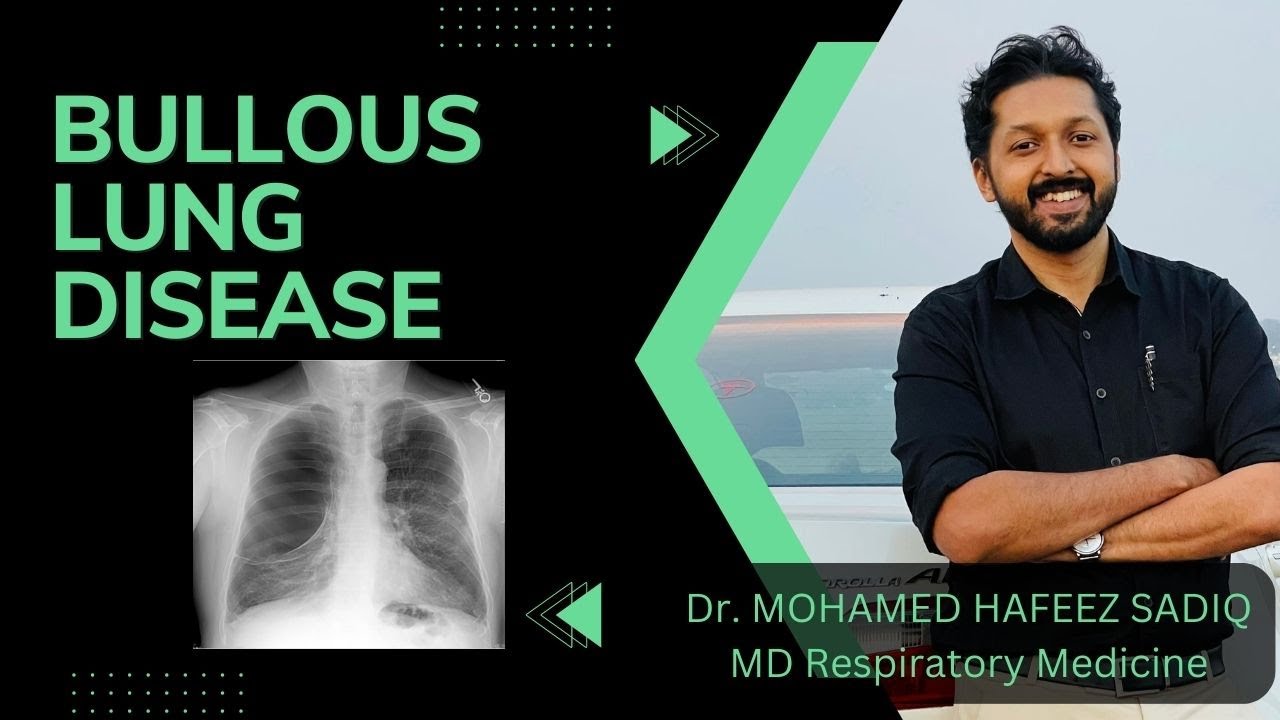 Bullous Lung Disease etiology-Part II - YouTube