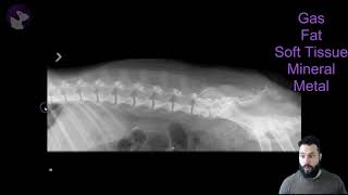 What Are The Radiographic Opacities?