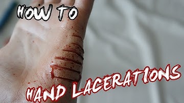 DIY Hand Lacerations with glue sticks