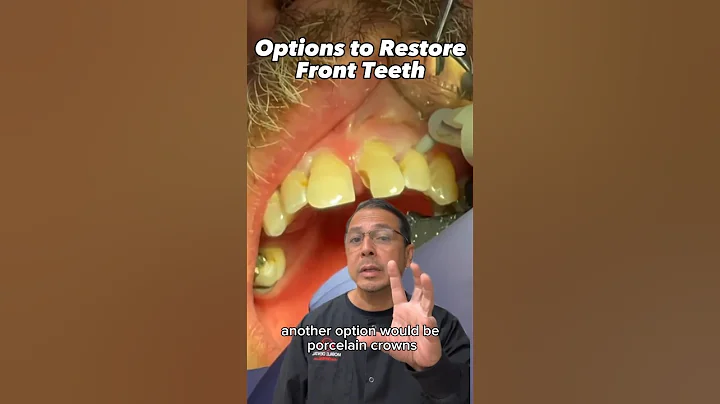Options to Improve Your Smile: Front Teeth Restoration | View Mobile Dental #shorts