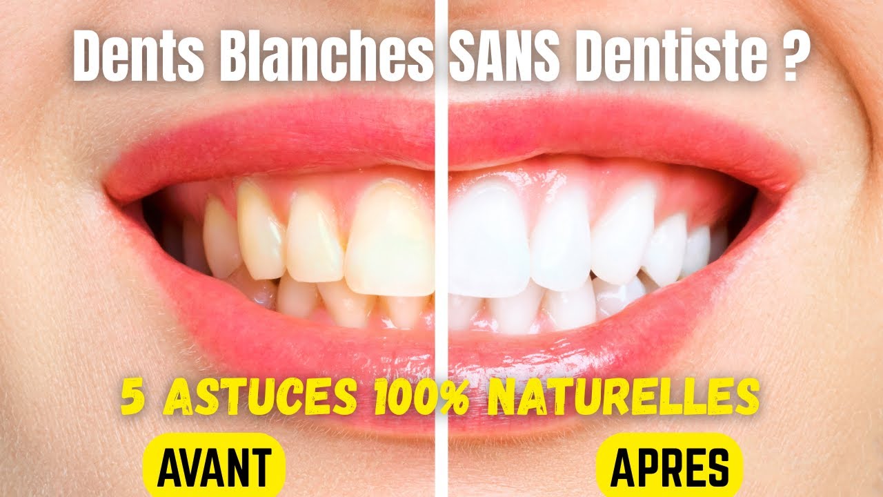 5 astuces faciles pour des dents blanches à la maison ! YouTube — free download