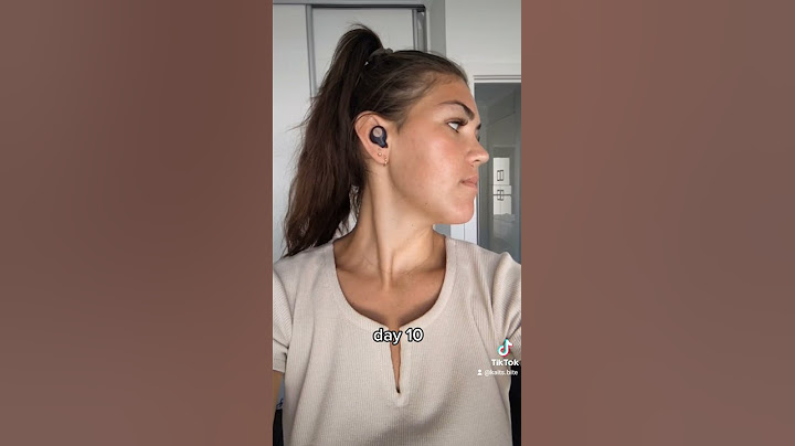 Jaw Surgery Recovery Day 6-10