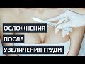 Осложнения после увеличения груди: ЧЕГО БОЯТЬСЯ??