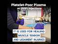 PPP Injections for Muscle Injuries Do They Work