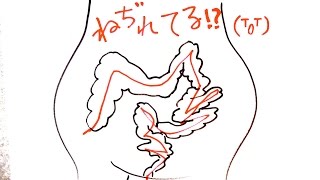 便秘解消 ３分 ねじれ腸マッサージ ねじれ腸チェックテストつき Youtube