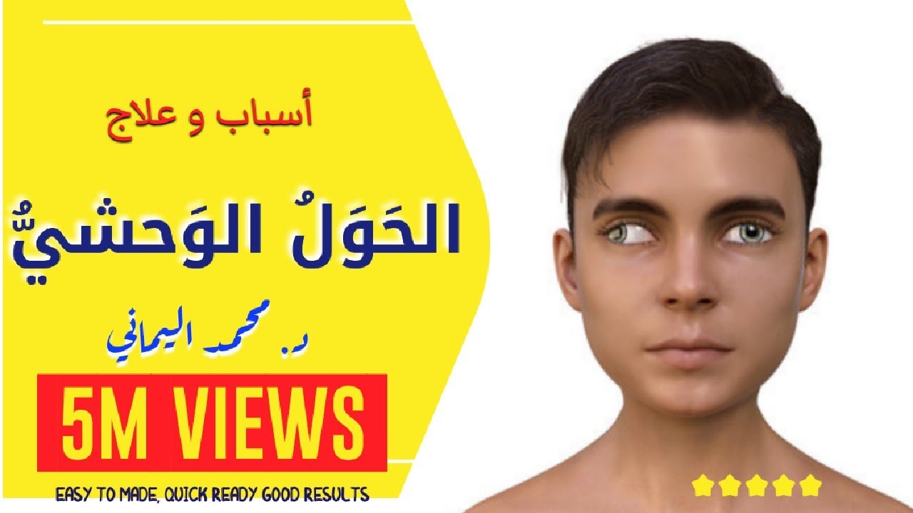 حول العين البسيط و علاجه - أسباب وعلاج الحول الوحشي عند الأطفال