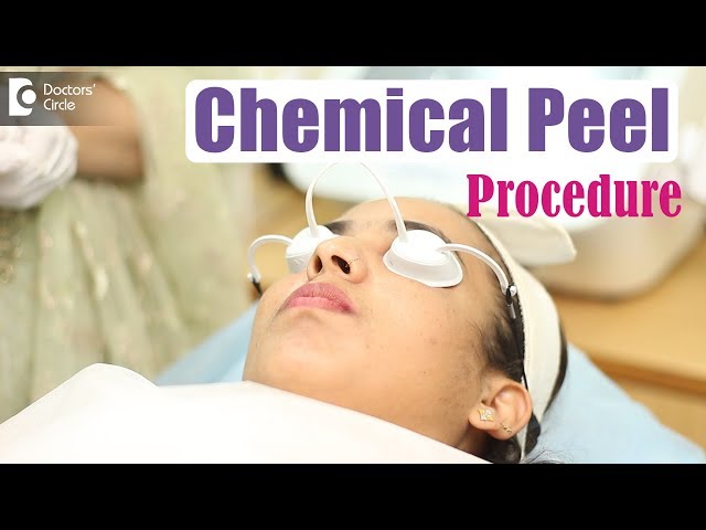 Chemical Peel Procedure | Dr. Divya Sharma| Doctors' Circle class=