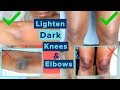 Lighten Dark Elbows & Knees | Skincare for SMOOTH &  SOFT Skin + DIY BODY OIL  | *Highly Requested*