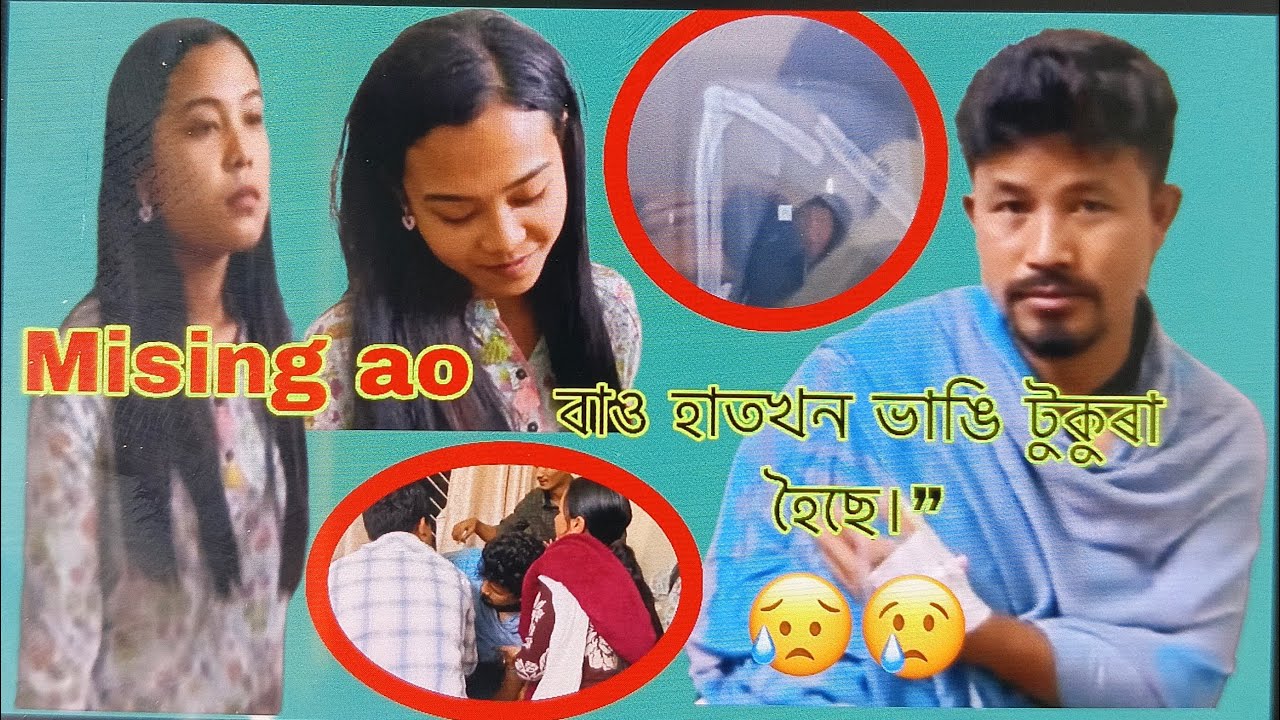 Mising ao (Ronju Mili) accident হল😢 বাও হাতখন ভাঙি টুকুৰা হৈছে#mralex1m 