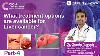 Play video: What treatment options are available for Liver cancer