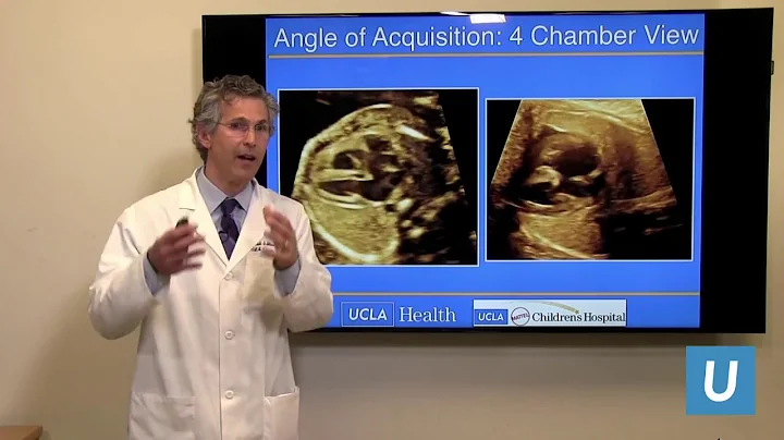 Fetal Cardiac Screening: How to Improve CHD Detect...