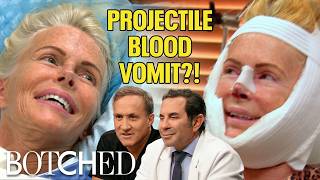 Kathy Vomited Blood After She Was Abandoned in Ecuador For Nose Job (Before & After) | Botched | E!