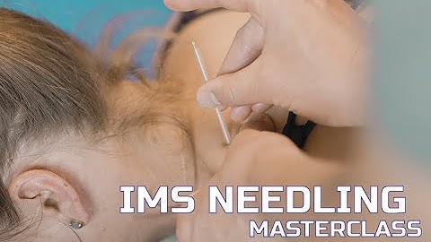 IMS Dry Needling Levator Scapulae- WhyThingsHurt.com