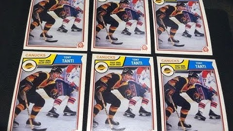 The Career of Tony Tanti