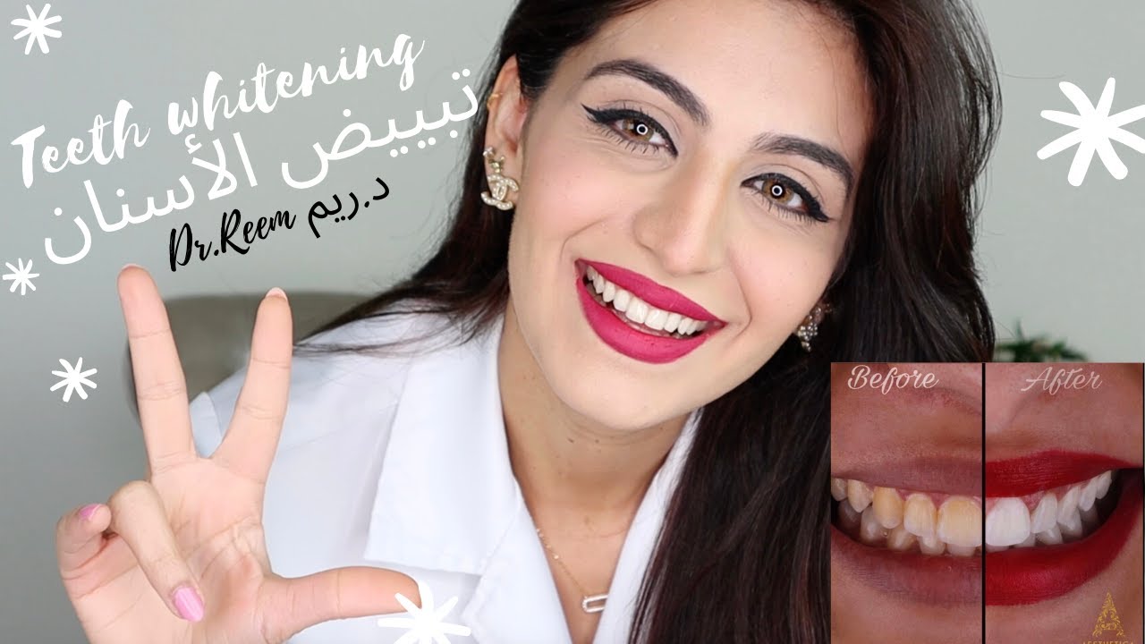 أفضل طريقة  لتبييض الأسنان  مع الدكتورة ريم الشيبه Best teeth whitening method