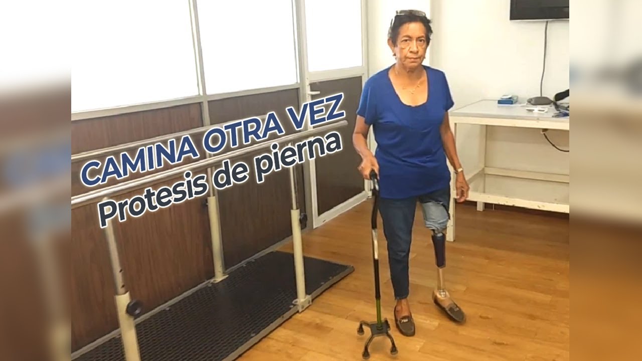 Vuelve a caminar con una prótesis de pierna YouTube