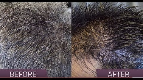 Formula 18 Grey Coverage