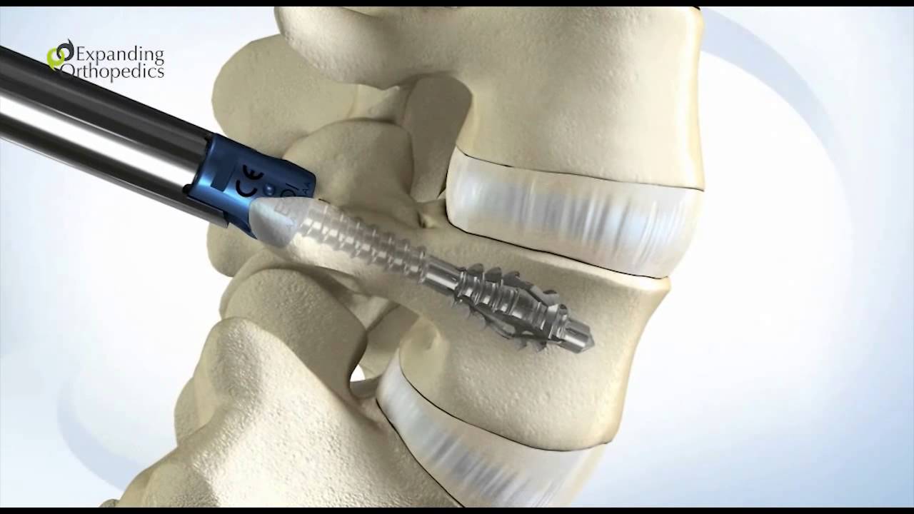 3ds סרט אנימציה בתלת מימד