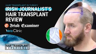 Irish Journalist's Hair Transplant Journey at Vera Clinic #hairtransplant  #hairtransplantturkey