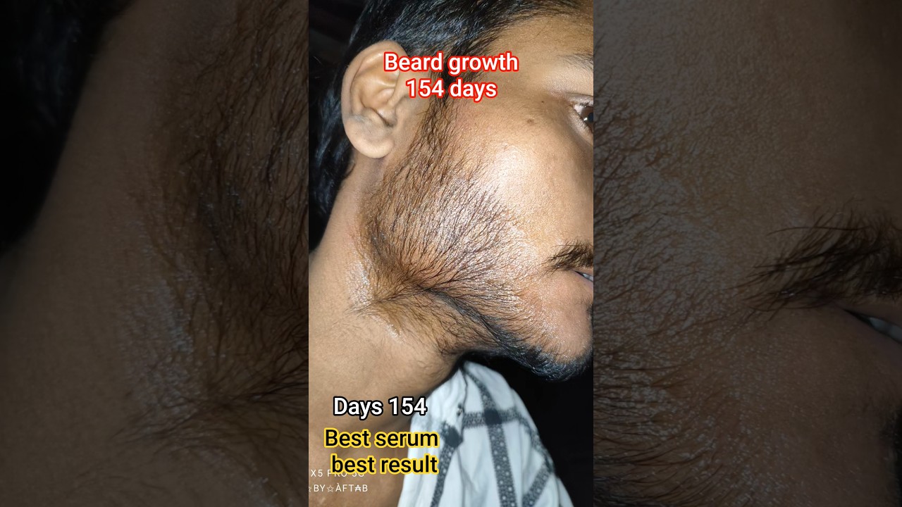 beard growth 154 days