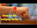 Wrist Problem Fixed In 5 Minutes Prominent Styloid Process Of Ulna By Physiotherapist 