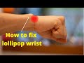 Wrist problem fixed in 5 minutes  prominent styloid process of ulna by physiotherapist