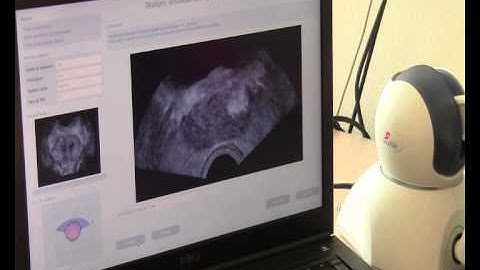 BiopSym - virtual reality simulator for prostate biopsy