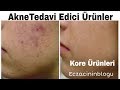 Kore Ürünleri İle Aknelerden Kurtulun|#koreürünleri #aknesizcilt