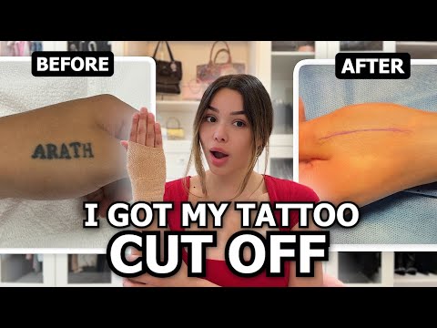 I Got My Tattoo Cut Off!!