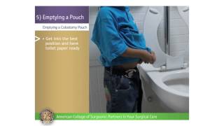 Pediatric Colostomy/Ileostomy: Emptying a Pouch