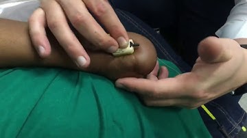 i-digits™ by Össur