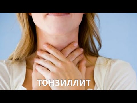 Хронический тонзиллит: как с ним жить?