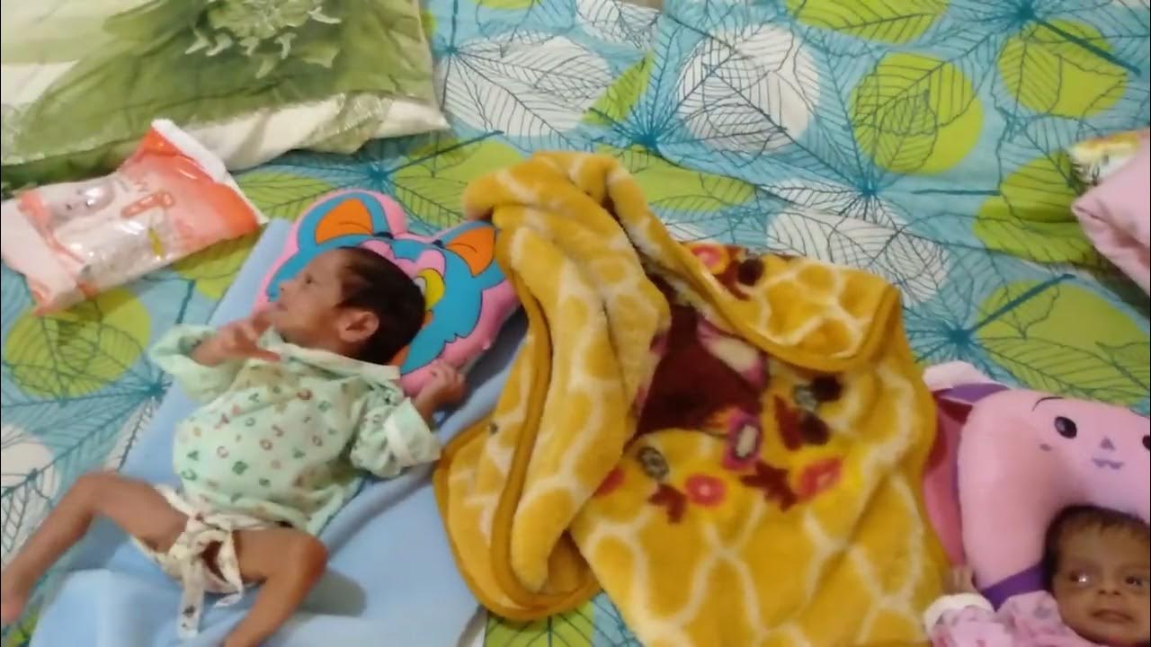 extremely-premature-twin-babies-born-at-33-week-birth-weight-only-910