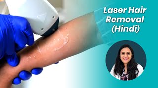 Laser Hair Removal (Hindi) | लेजर से बालों को हटाना | Before & After Results