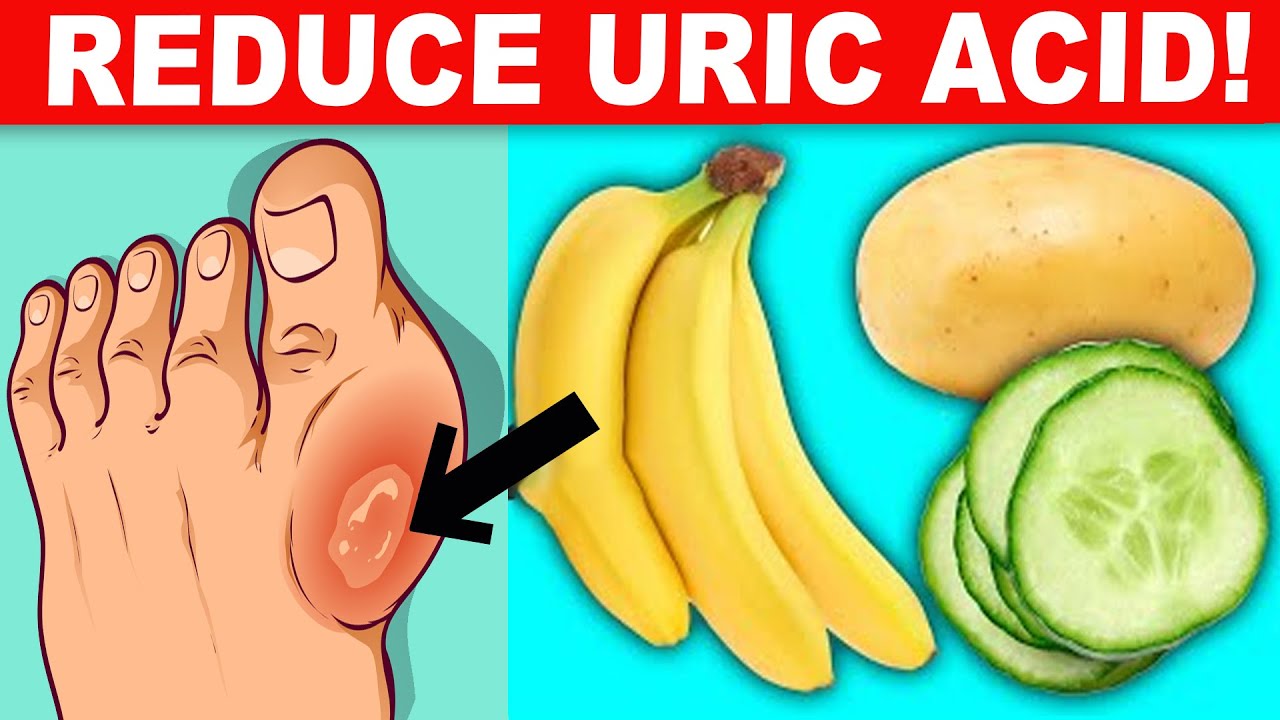 12 Foods That Reduce Your Uric Acid Levels Youtube