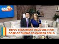 Hipec treatment delivers high dose of chemotherapy to cancer cells  new day nw