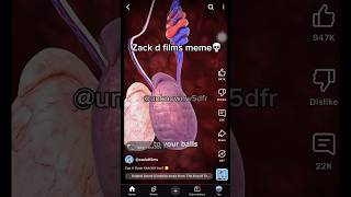 Zack d films meme#shorts#ytp#memes