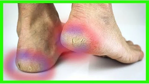 Co je krém na ruce Hand & Nail?