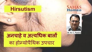 Hirsutism Treatment in Homeopathy | महिलाओं में अनचाहे व अत्यधिक बालों का आना | हिर्सुटिज़्म