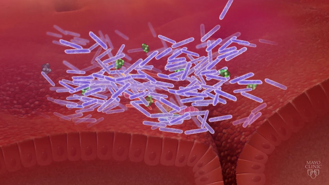 The Gut Microbiome And C. Difficile