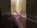 يمهه قرصتني عقربه