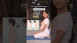 How to correct your posture Easy way to fix your neck hump #yoga #yogagirl #shorts