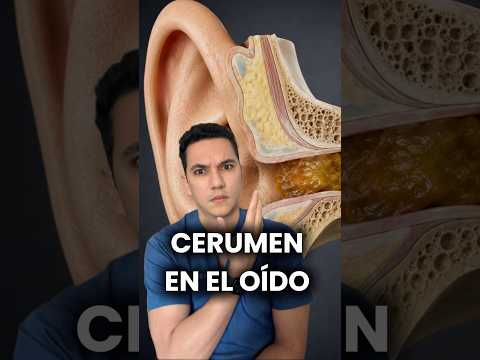 El cerumen no es sociedad, es protección para tu oído. #medicina #consejosdesalud #saludybienestar