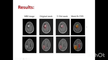 Brain Tumor segmentation using U-Net Compared with Mask R-CNN
